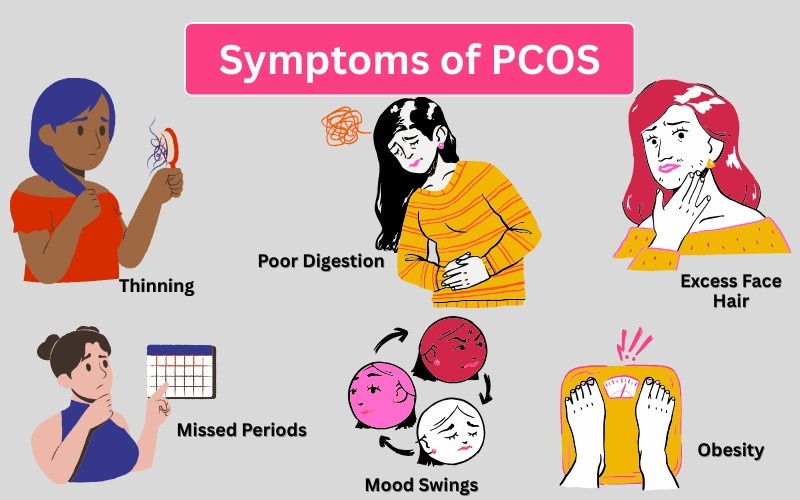 PCOS Symptoms