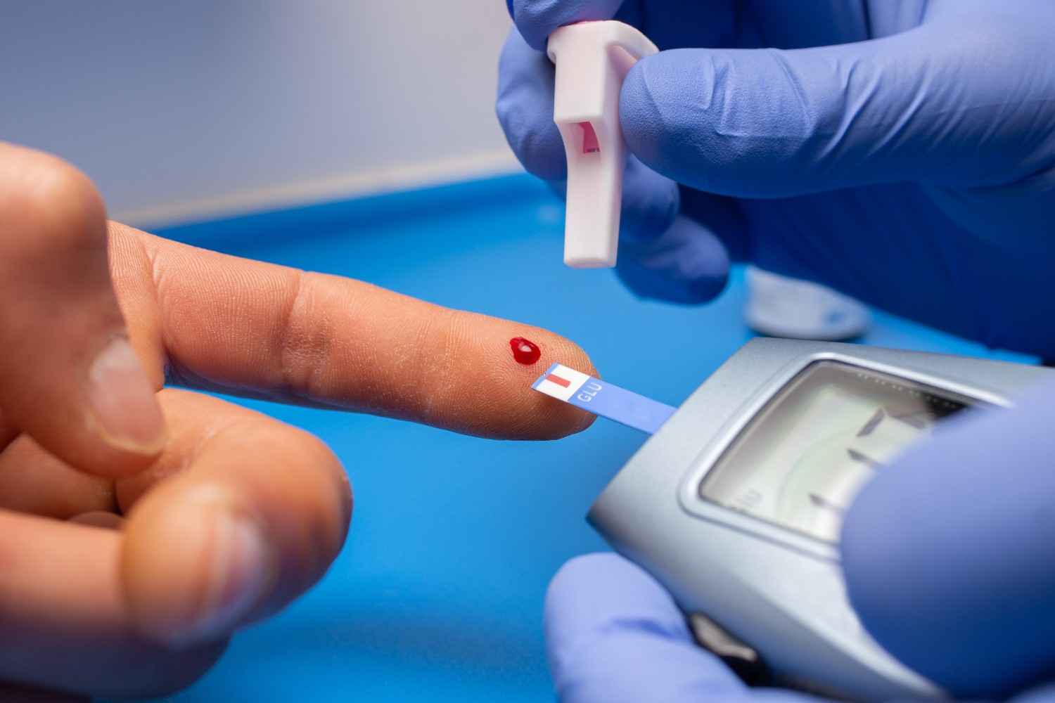 Early Signs and Symptoms of Type 2 Diabetes